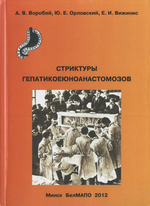 Стриктуры гепатикоеюноанастомозов. Воробей